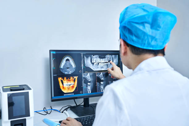 Best Emergency Tooth Extraction in Bartonvle, IL